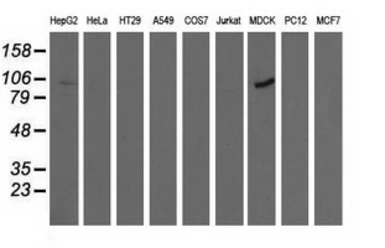 Anti-ALDH1L1 antibody [6A10] used in Western Blot (WB). GTX84891