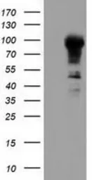 Anti-ALDH1L1 antibody [5G8] used in Western Blot (WB). GTX84892