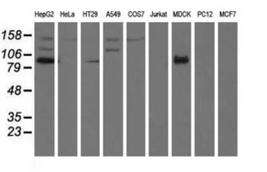 Anti-ALDH1L1 antibody [5G8] used in Western Blot (WB). GTX84892