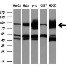 Anti-ALDH1L1 antibody [7G6] used in Western Blot (WB). GTX84894