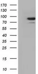 Anti-ALDH1L1 antibody [7B7] used in Western Blot (WB). GTX84895