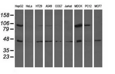 Anti-ALDH1L1 antibody [1H6] used in Western Blot (WB). GTX84897