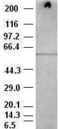 Anti-AKT3 antibody [9B2] used in Western Blot (WB). GTX84906