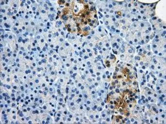 Anti-AKR1A1 antibody [8H2] used in IHC (Paraffin sections) (IHC-P). GTX84915