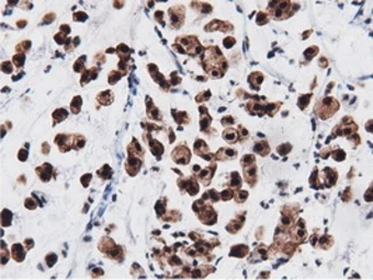 Anti-AK5 antibody [2F9] used in IHC (Paraffin sections) (IHC-P). GTX84921