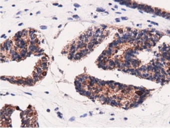 Anti-AK5 antibody [2F9] used in IHC (Paraffin sections) (IHC-P). GTX84921