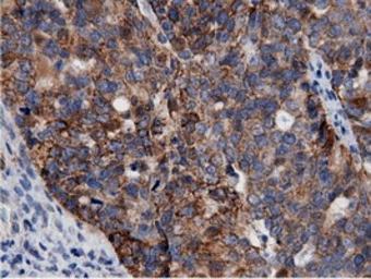 Anti-AK5 antibody [2F9] used in IHC (Paraffin sections) (IHC-P). GTX84921