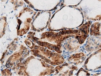 Anti-AK5 antibody [2F9] used in IHC (Paraffin sections) (IHC-P). GTX84921