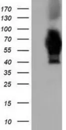 Anti-AK5 antibody [2F9] used in Western Blot (WB). GTX84921