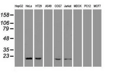 Anti-Adenylate kinase 1 antibody [4A1] used in Western Blot (WB). GTX84936