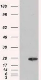 Anti-Adenylate kinase 1 antibody [8A1] used in Western Blot (WB). GTX84938