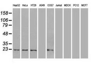 Anti-Adenylate kinase 1 antibody [8A1] used in Western Blot (WB). GTX84938