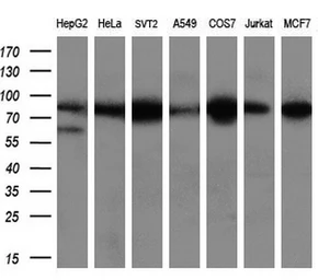 Anti-Aconitase 2 antibody [7G4] used in Western Blot (WB). GTX84965