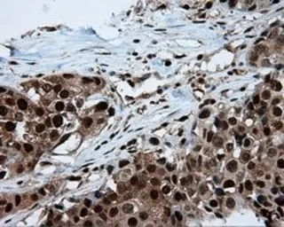 Anti-ATP citrate lyase antibody [3G8] used in IHC (Paraffin sections) (IHC-P). GTX84967