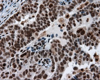 Anti-ATP citrate lyase antibody [3G8] used in IHC (Paraffin sections) (IHC-P). GTX84967