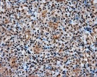 Anti-ATP citrate lyase antibody [3G8] used in IHC (Paraffin sections) (IHC-P). GTX84967
