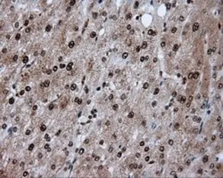 Anti-ATP citrate lyase antibody [3G8] used in IHC (Paraffin sections) (IHC-P). GTX84967