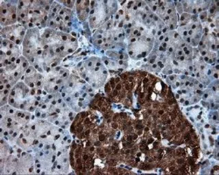 Anti-ATP citrate lyase antibody [3G8] used in IHC (Paraffin sections) (IHC-P). GTX84967