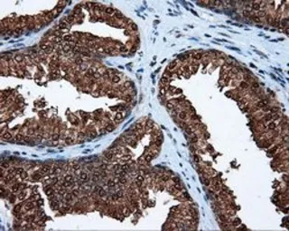 Anti-ATP citrate lyase antibody [3G8] used in IHC (Paraffin sections) (IHC-P). GTX84967