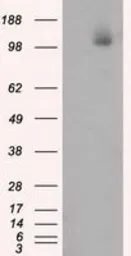 Anti-ATP citrate lyase antibody [3G8] used in Western Blot (WB). GTX84967