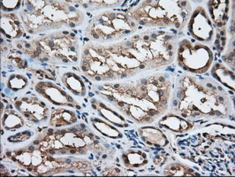 Anti-ACAT2 antibody [1B7] used in IHC (Paraffin sections) (IHC-P). GTX84968