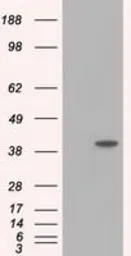 Anti-ACAT2 antibody [1B7] used in Western Blot (WB). GTX84968