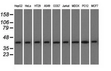 Anti-ACAT2 antibody [1B7] used in Western Blot (WB). GTX84968