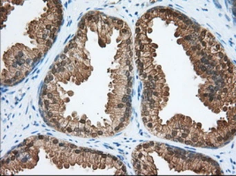 Anti-ACAT2 antibody [3C9] used in IHC (Paraffin sections) (IHC-P). GTX84971