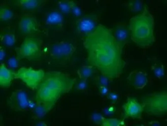 Anti-ACAT2 antibody [1C5] used in Immunocytochemistry/ Immunofluorescence (ICC/IF). GTX84977