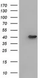 Anti-ACAT2 antibody [1C5] used in Western Blot (WB). GTX84977
