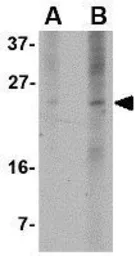 Anti-PUMA antibody [10C5G1] used in Western Blot (WB). GTX84990