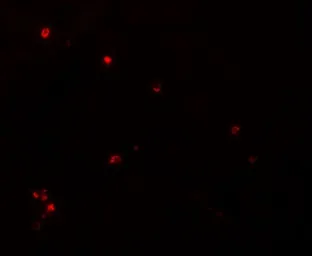 Anti-NDUFB9 antibody used in IHC (Paraffin sections) (IHC-P). GTX85007