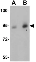 Anti-DCLK1 antibody used in Western Blot (WB). GTX85008