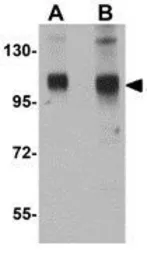 Anti-SH3BP4 antibody used in Western Blot (WB). GTX85017