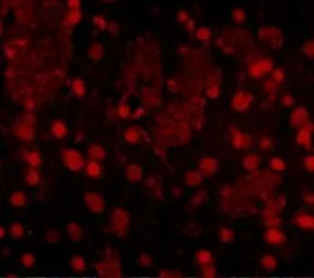 Anti-FTO antibody used in IHC (Paraffin sections) (IHC-P). GTX85019