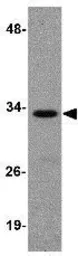Anti-RNAse H2A antibody used in Western Blot (WB). GTX85020