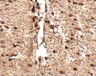 Anti-MEX3D antibody used in IHC (Paraffin sections) (IHC-P). GTX85026