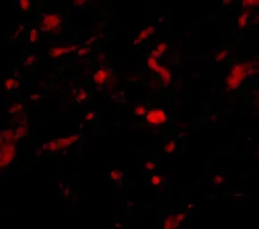 Anti-NENF antibody used in IHC (Paraffin sections) (IHC-P). GTX85028