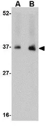 Anti-NENF antibody used in Western Blot (WB). GTX85028