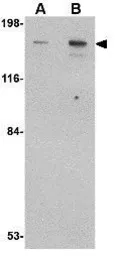 Anti-CLIP170 antibody used in Western Blot (WB). GTX85030