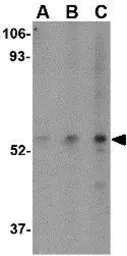Anti-SP110 antibody used in Western Blot (WB). GTX85042