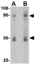 Anti-NHE-1 antibody used in Western Blot (WB). GTX85046