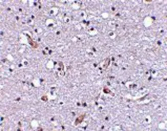 Anti-NHE-1 antibody used in IHC (Paraffin sections) (IHC-P). GTX85047