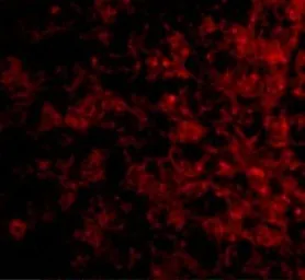 Anti-CRLF2 antibody used in IHC (Paraffin sections) (IHC-P). GTX85052