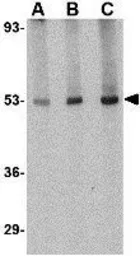 Anti-CRLF2 antibody used in Western Blot (WB). GTX85052