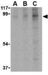Anti-BRSK2 antibody used in Western Blot (WB). GTX85053