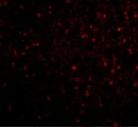 Anti-BRSK2 antibody used in IHC (Paraffin sections) (IHC-P). GTX85053
