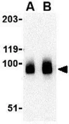 Anti-BRSK1 antibody used in Western Blot (WB). GTX85055