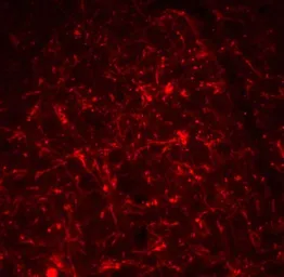 Anti-TSLP antibody used in IHC (Paraffin sections) (IHC-P). GTX85059