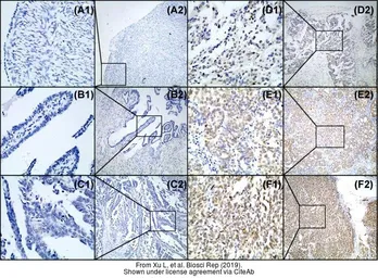 Anti-TSLP antibody used in IHC (Paraffin sections) (IHC-P). GTX85060